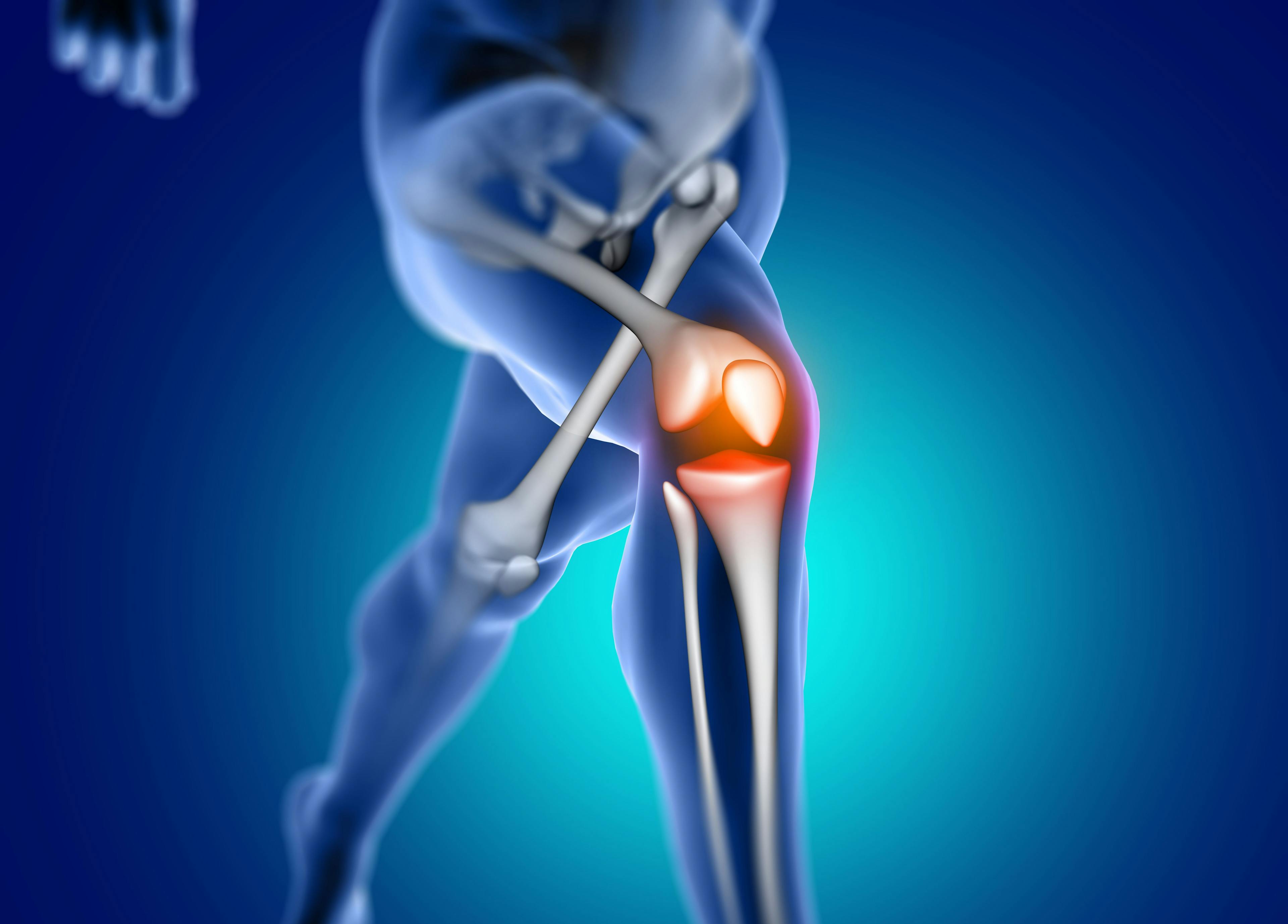 obrázok fyzioterapie kolena